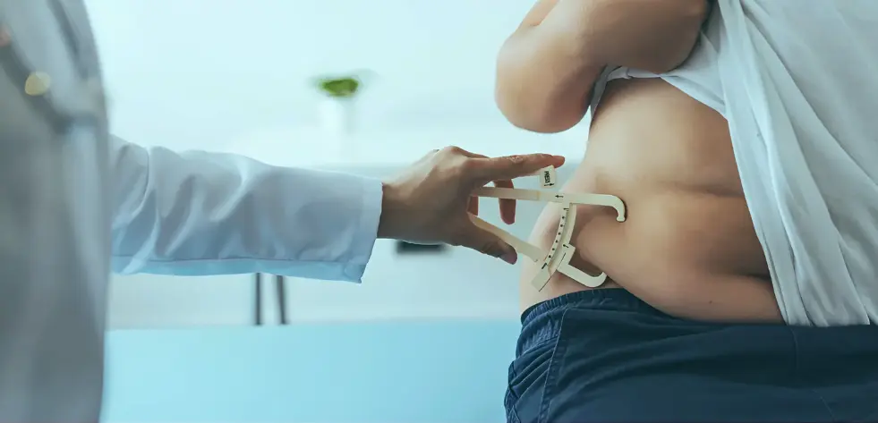 Bariatric Surgery